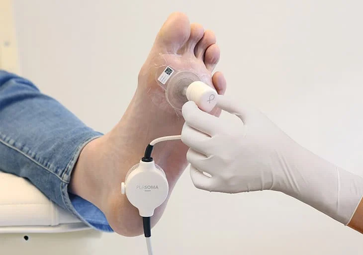 A sensor on the bottom of a foot